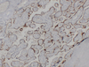 मानव immunoblotting monoclonal एंटीबॉडी के लिए एंटी-एचसीजी बीटा माउस माॅब