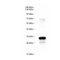 //jrrorwxhrkinlm5p-static.micyjz.com/cloud/ljBpjKnjlkSRqippqjmlip/f2f31d71d0a1f7a662a12f5311f9a43e-60-60.jpg
