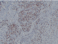 IHC Immunofluorescence एंटीबॉडी के लिए एंटी-मायोजेनिन माउस एमएबी