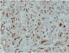 एंटी -पीएसएमए माउस मैब मोनोक्लोनल प्राथमिक एंटीबॉडीएस 50ul