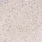 //jrrorwxhrkinlm5p-static.micyjz.com/cloud/lmBpjKnjlkSRqiqpimloiq/695e1d9a2874c601a0ca67e1ab0779d8-60-60.jpg