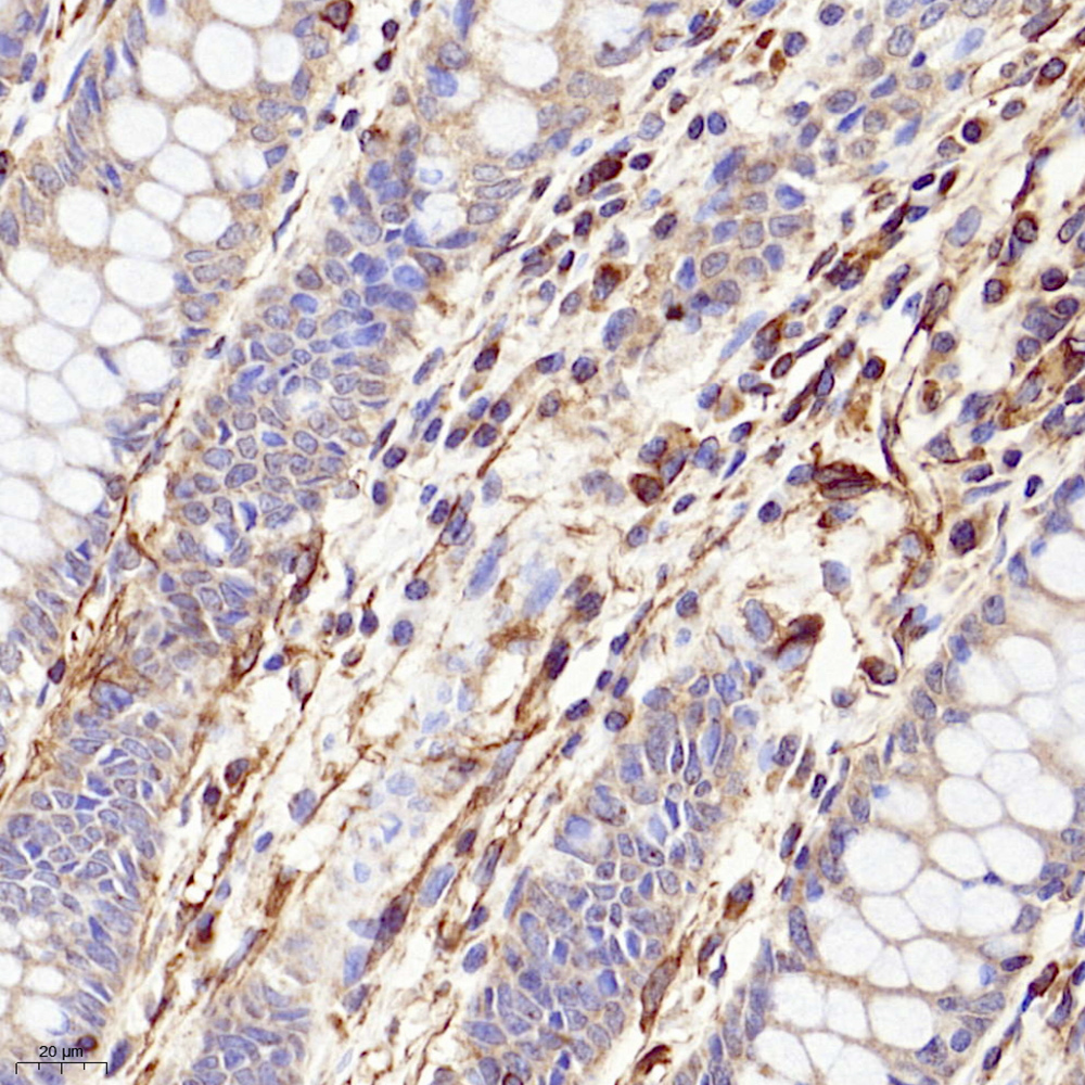 GB11192 एफ़िनिटी शुद्धि एंटी-वीरिमेंटिन खरगोश पीएबी