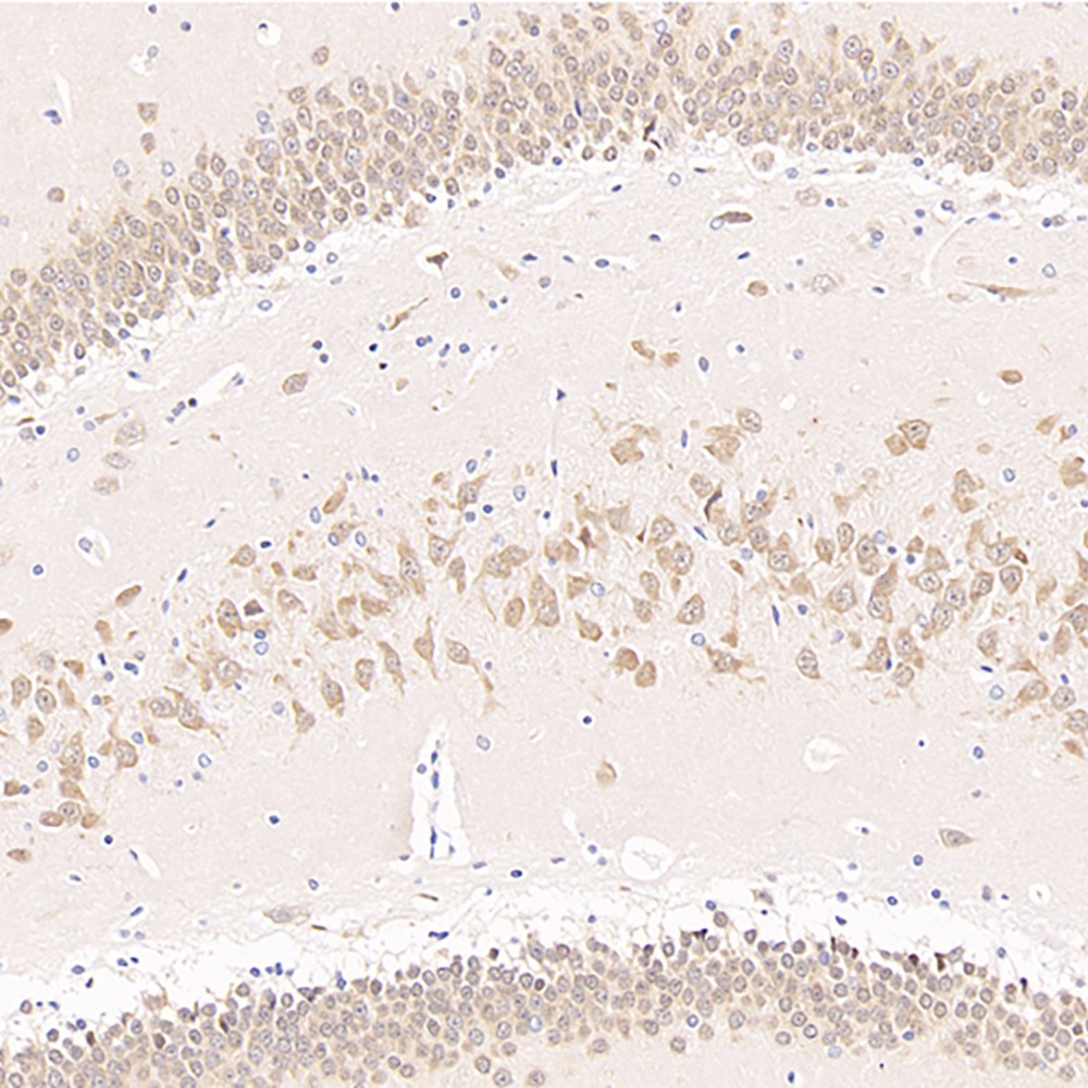 GB11138 जैविक विरोधी न्युन खरगोश पब