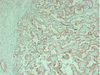 Immunohistocemistry immunofluorescence monoclonal एंटीबॉडी के लिए एंटी -सिटोकरैटिन 18 माउस एमएबी