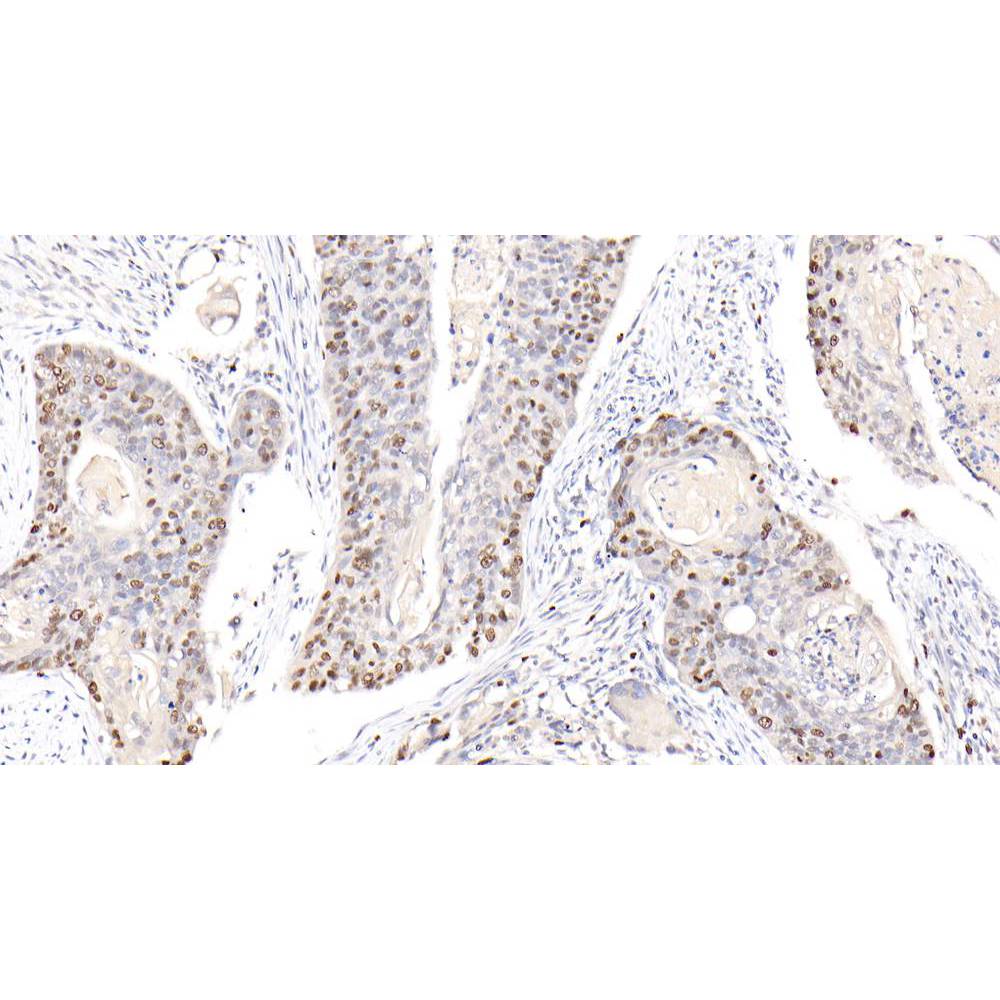 कैंसर रिसर्च IHC के लिए एंटी -67 खरगोश पाब यदि प्राथमिक एंटीबॉडी है